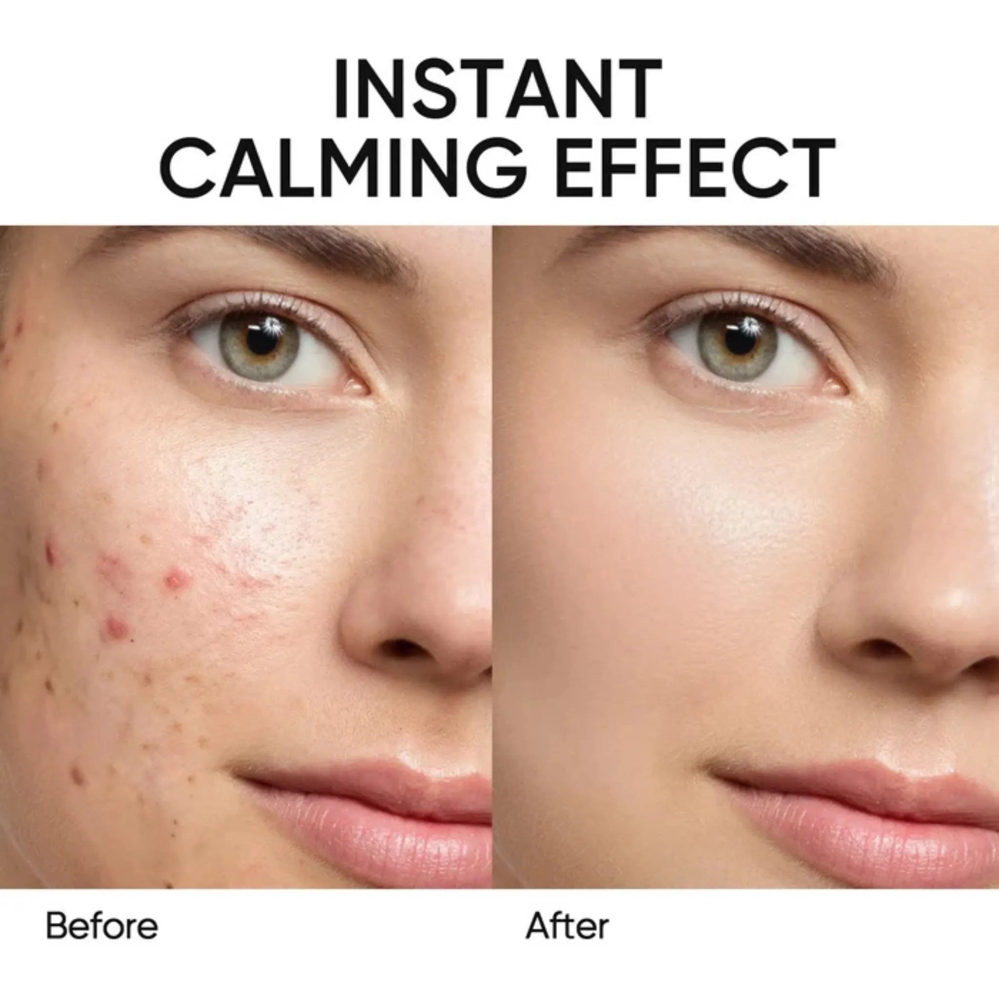 Mugwort Anti-Acne Clay Stick | Salicylic Acid Pore Treatment