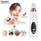 5 in 1 Electric Vacuum Pore Cleaner | 5 Suction Heads | Deep Clean