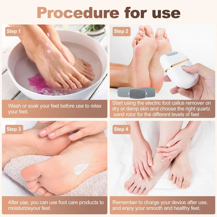 Electric Callus Remover | 3 Grinding Heads