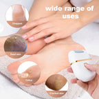 Electric Callus Remover | 3 Grinding Heads