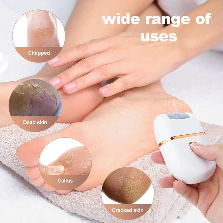 Electric Callus Remover | 3 Grinding Heads