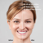 EMS V-Contour Jawline Sculptor