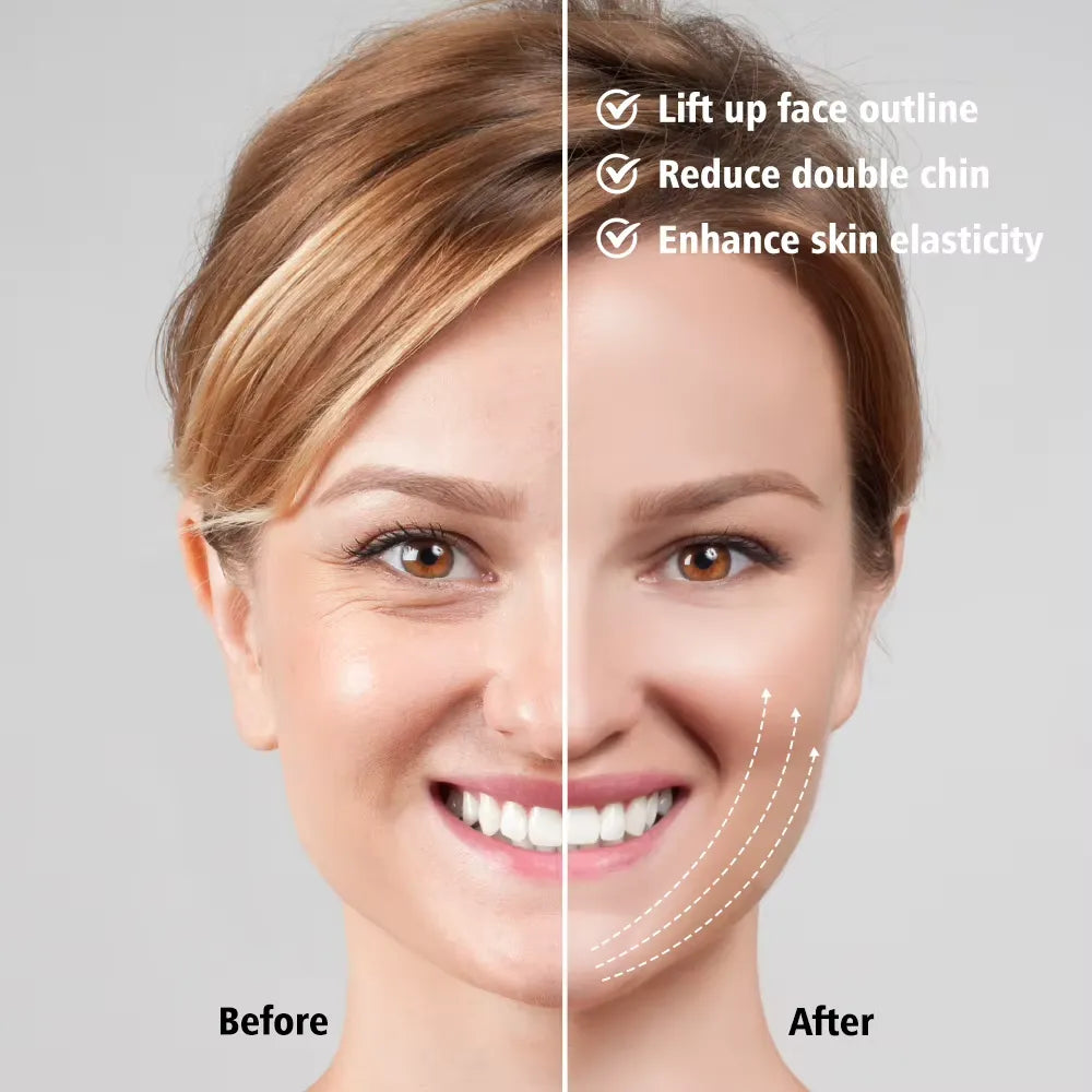 EMS V-Contour Jawline Sculptor