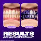 Ultra Whitening Kit | Hismile Toothpaste + Whitening Strips