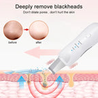 Electric Blackhead Scraper | Deep Clean. No Squeezing. No Marks.