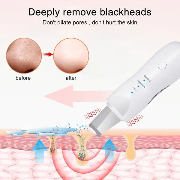 Electric Blackhead Scraper | Deep Clean. No Squeezing. No Marks.
