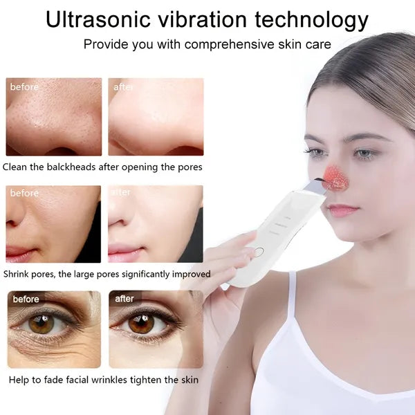 Electric Blackhead Scraper | Deep Clean. No Squeezing. No Marks.