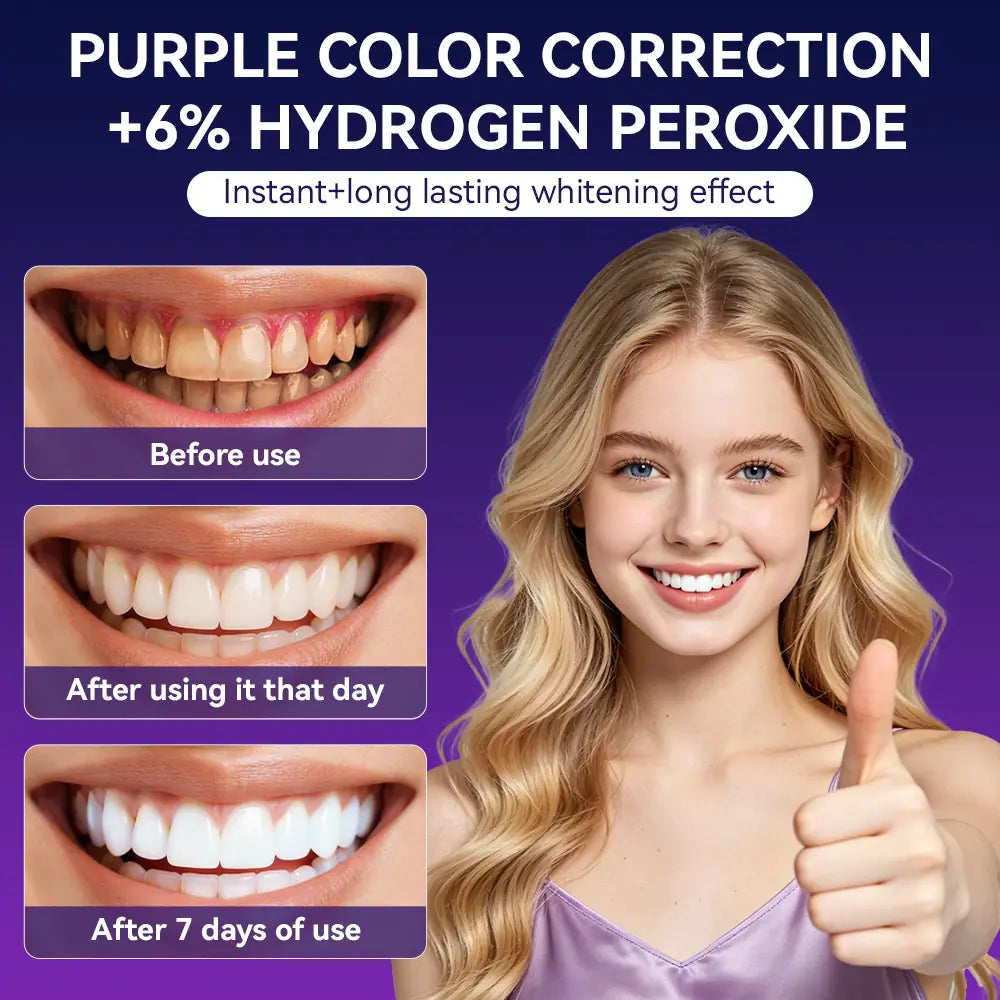 Smile Whitening Kit - Which is better decide for your self!